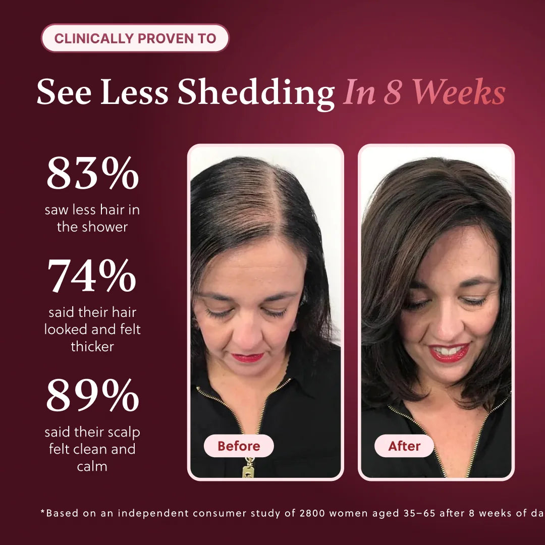 ForChics Hair Growth Shampoo