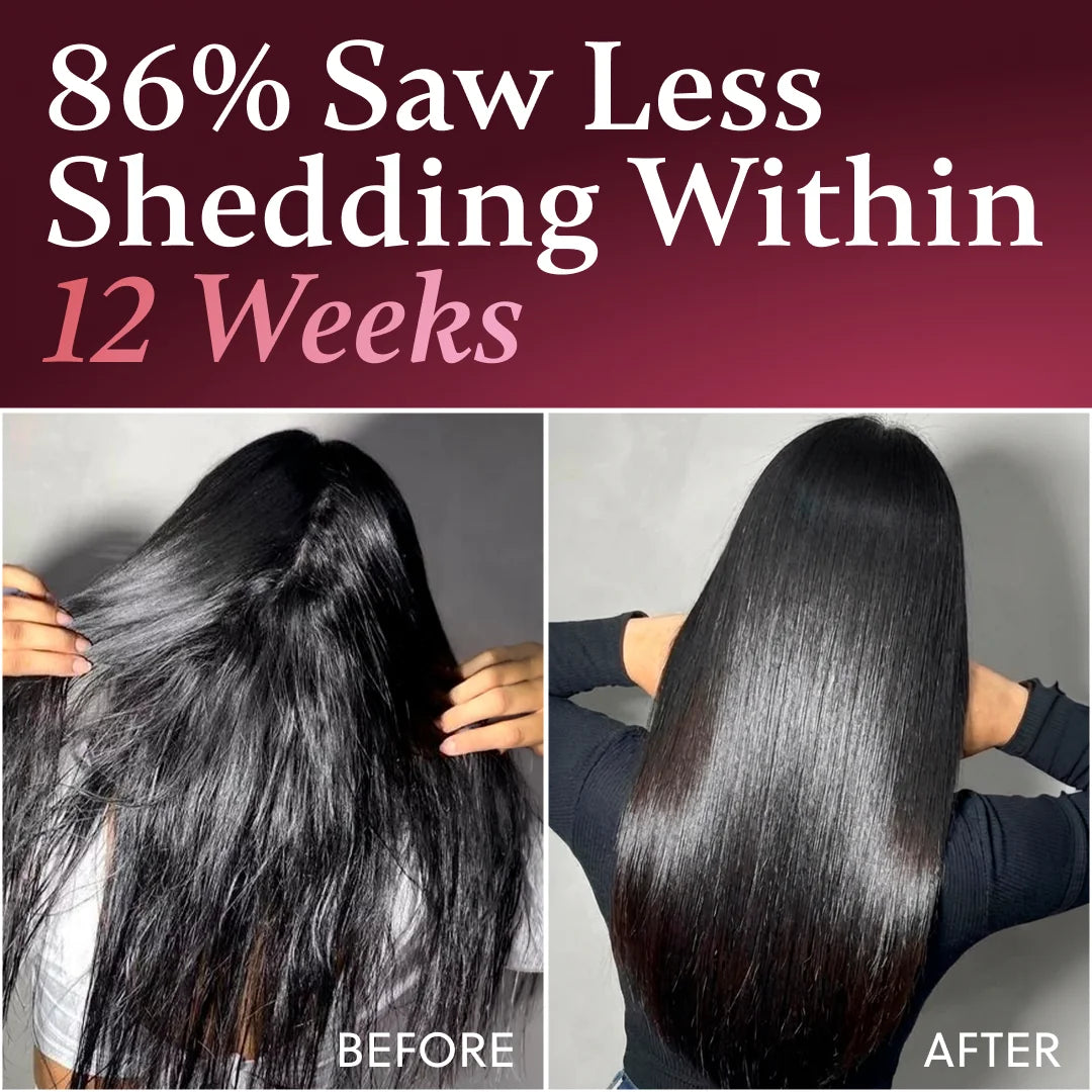 ForChics Hair Growth Shampoo