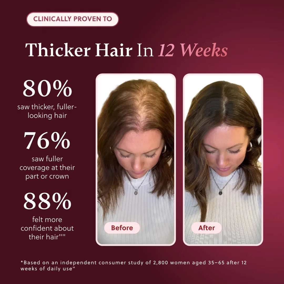 ForChics Hair Growth Spray