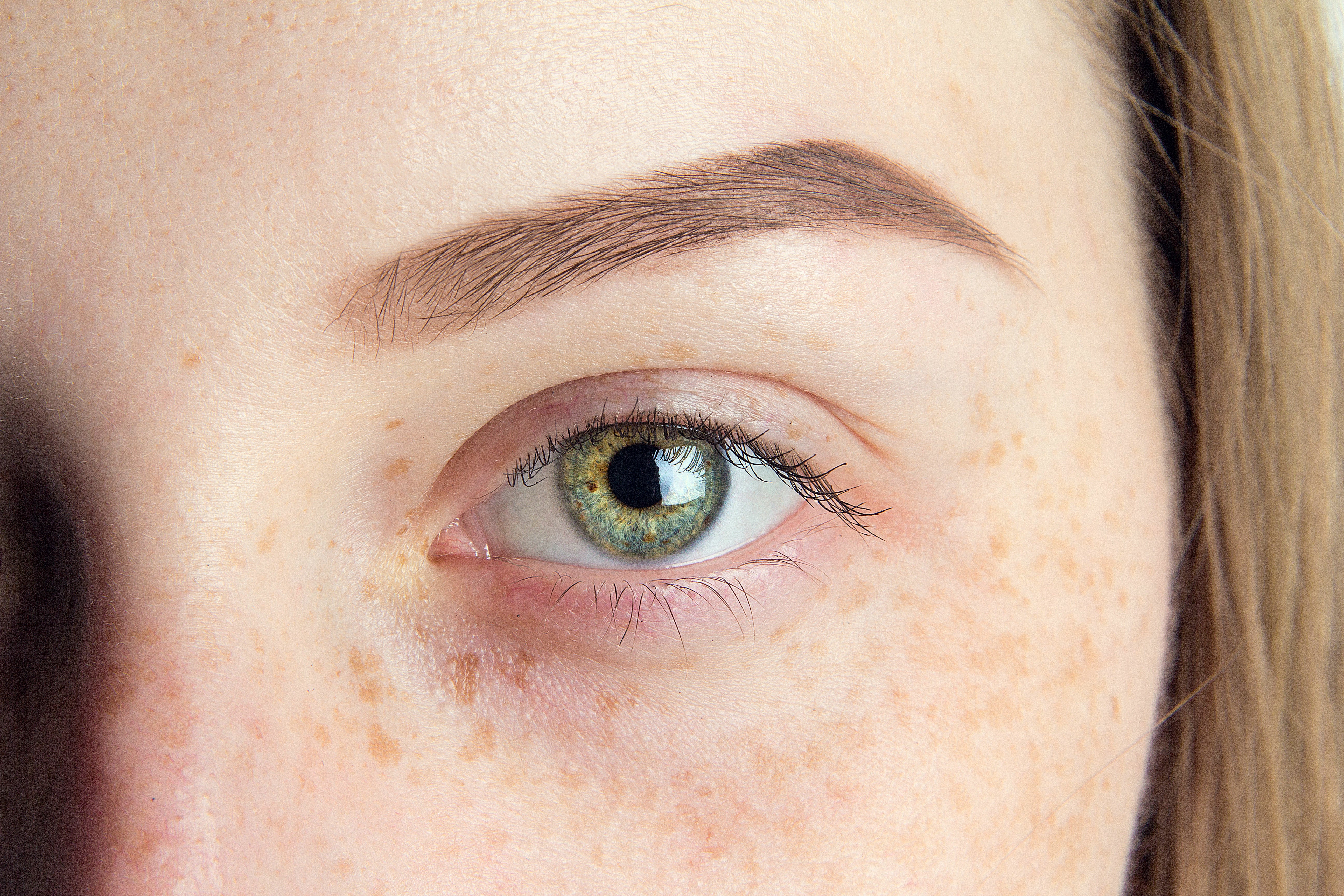 Thinning Eyebrows: Causes, Preventions, & Solutions