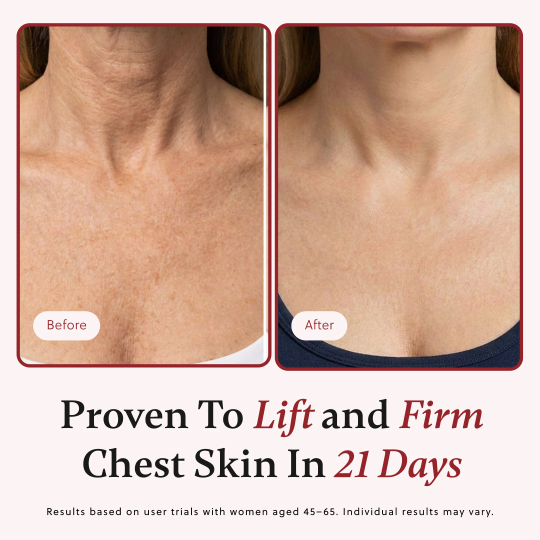 ForChics Body Oil