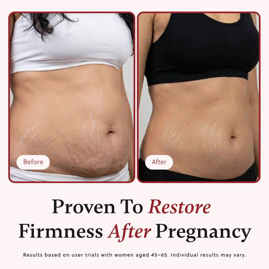 ForChics Body Oil