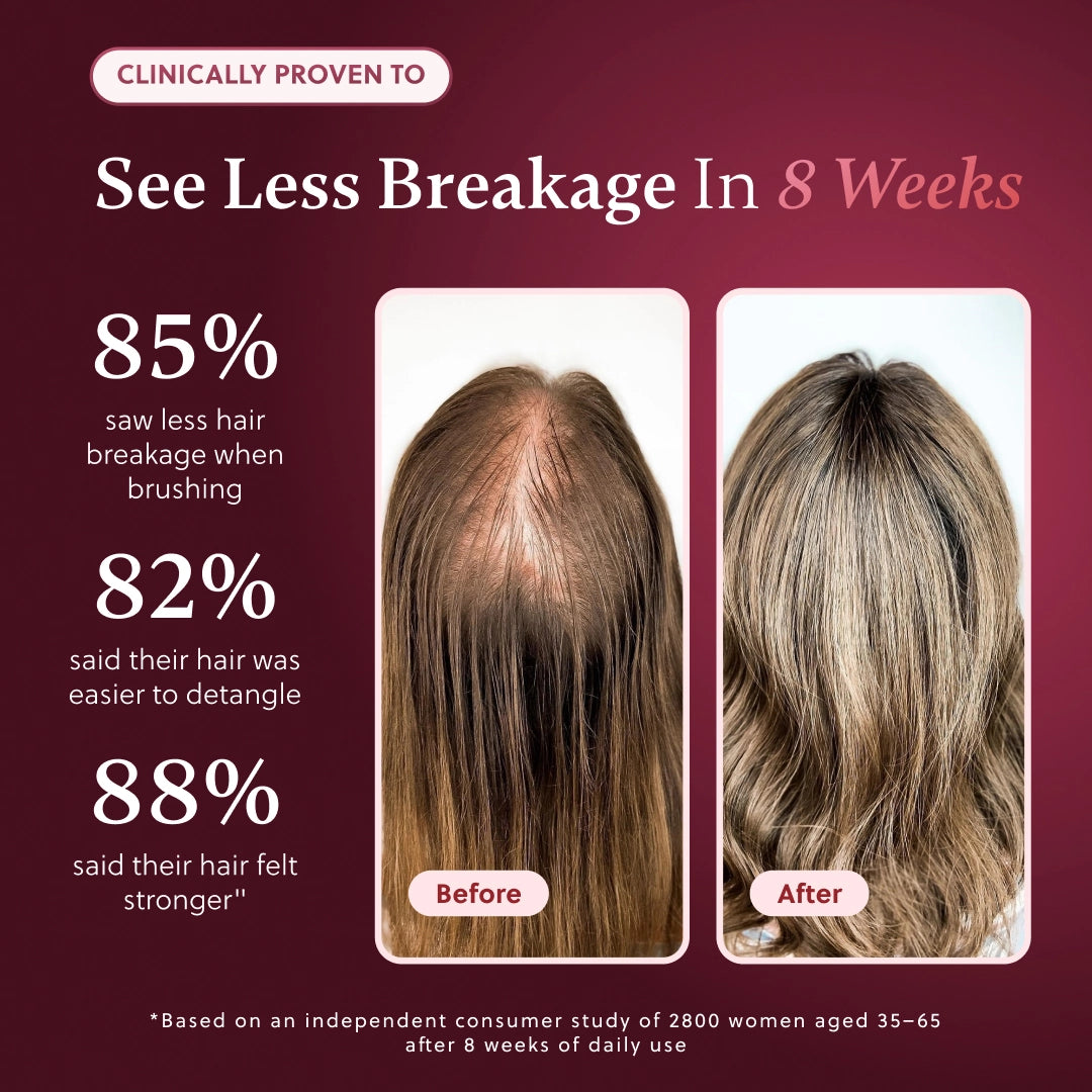 ForChics Hair Growth Conditioner