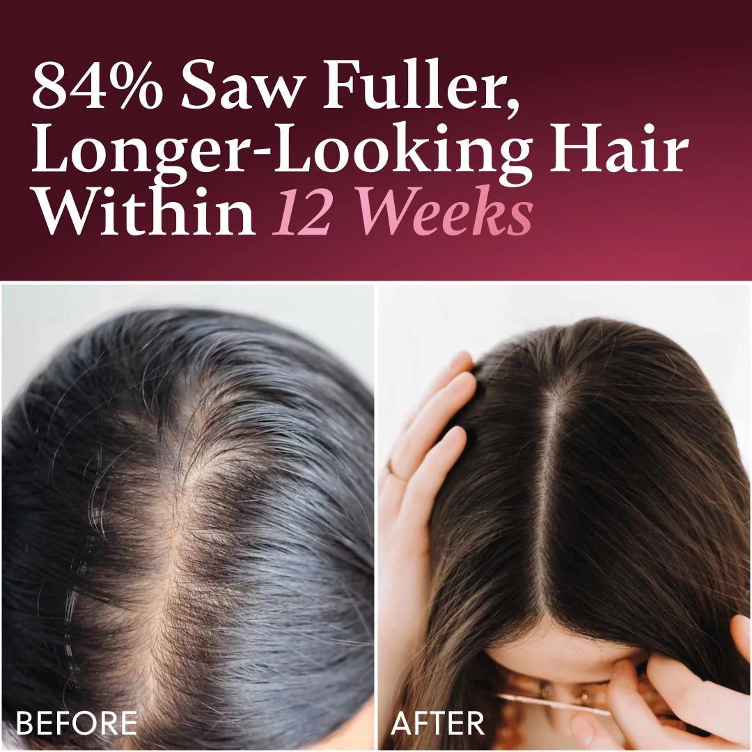 ForChics Hair Growth Conditioner