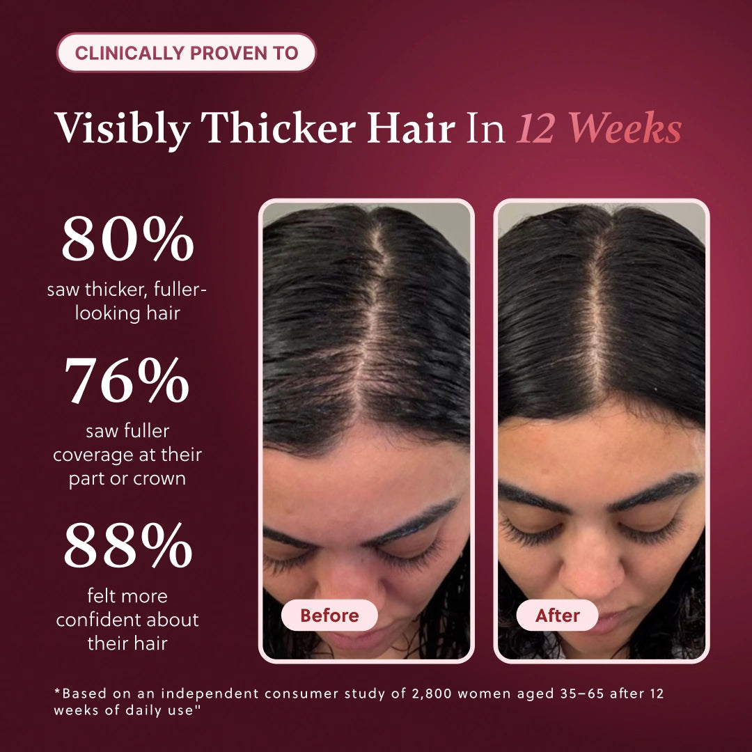 ForChics Hair Growth Density Refill