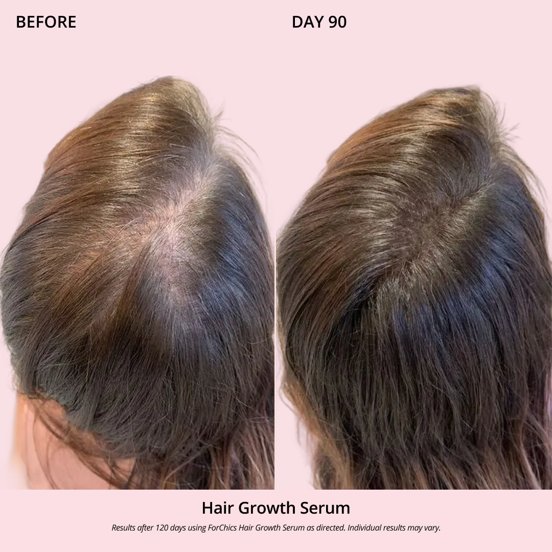 Hair Growth Oil Spray