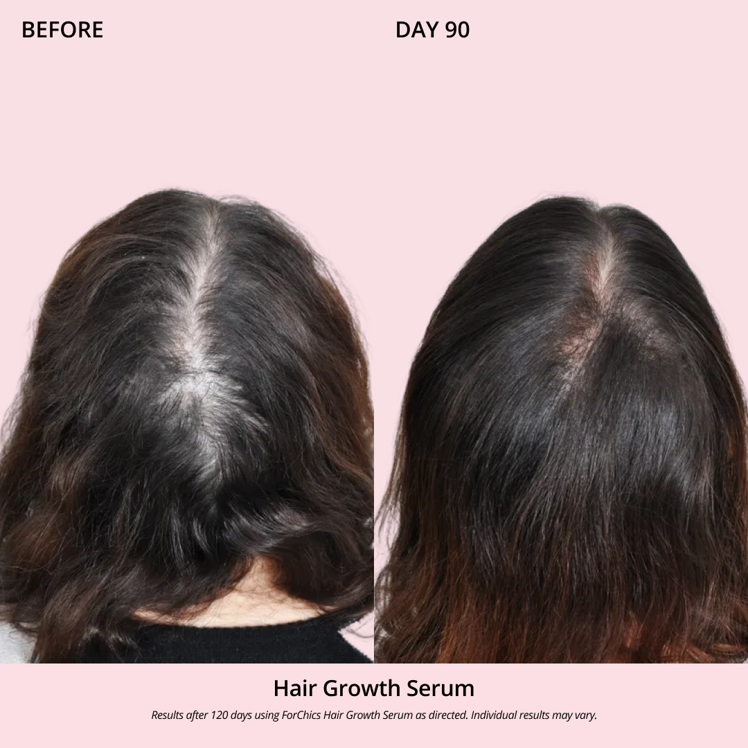 Hair Growth Oil Spray