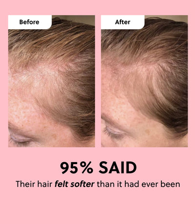 Hair Growth Oil Spray